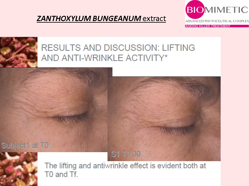 ZANTHOXYLUM BUNGEANUM extract